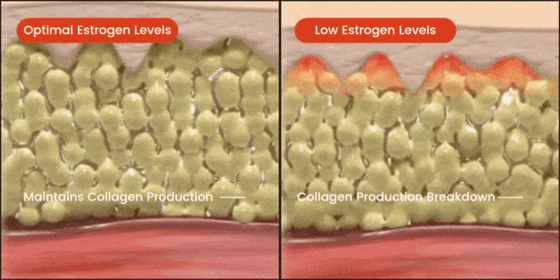 Low collagen production diagram